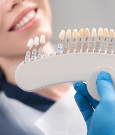 A dentist using a shade guide to determine the correct color for the composite resin to be used for cosmetic bonding