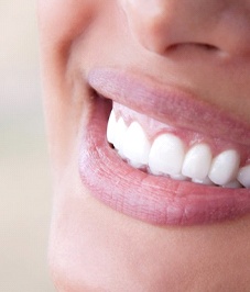 Closeup of whitened smile thanks to Horsham dentist