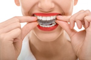 Your dentist in Horsham explains the benefits of Invisalign. 